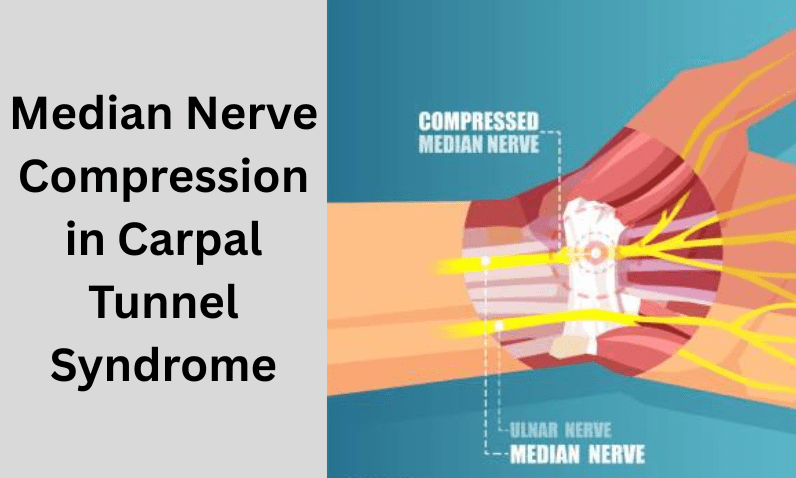 The Impact of Median Nerve Compression in Carpal Tunnel Syndrome - Made to Aid